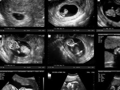 娄底试管婴儿医院技术排名，市中心医院值得推荐