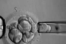 三代试管九周胚芽长得慢正常,偏大偏小都有可能